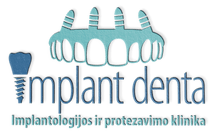 Implantdenta logotipas