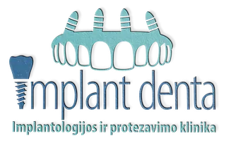 Implantdenta logotipas